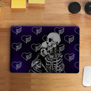 Lost Lovers Laptop Skin waterproof vinyl decal for laptop, bike, car & bottle